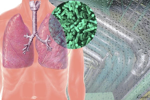 Three ways Legionnaires' Disease can damage your business and reputation - London Business News | Londonlovesbusiness.com